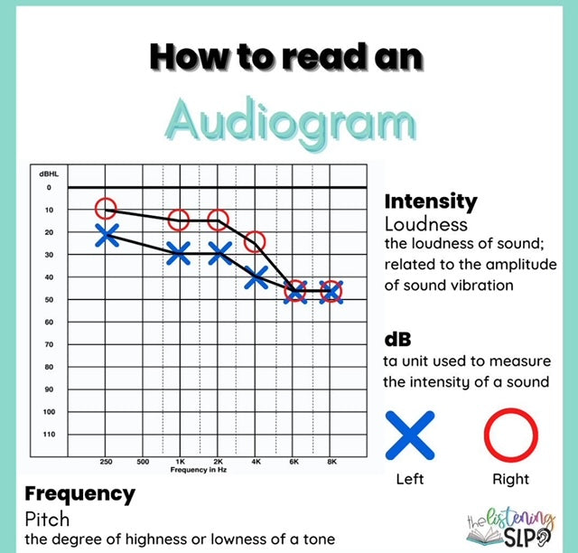 Deciphering Sound: A Guide to Understanding and Reading an Audiogram
