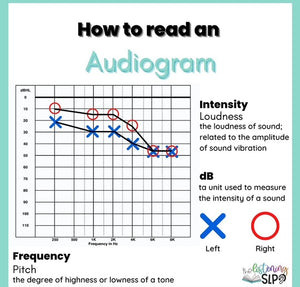 Deciphering Sound: A Guide to Understanding and Reading an Audiogram